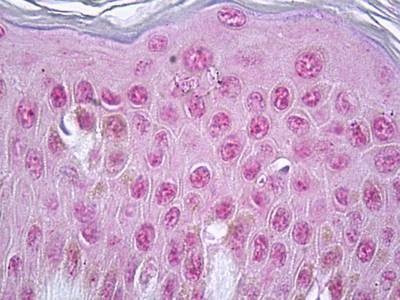 Anti-Vitamin D Receptor (Internal) Antibody