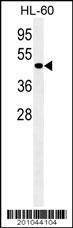 Anti-ATG4D Antibody
