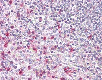 Anti-NFAT5 (C-term) Antibody