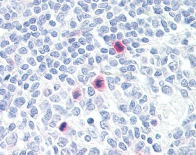 Anti-PLA2G4 / PLA2G4A (Internal) Antibody