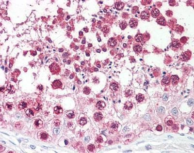 Anti-CSE1L (N-term) Antibody
