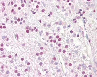 Anti-SF1 (N-term) Antibody