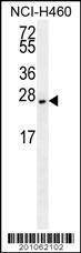 Anti-EIF4E2 Antibody