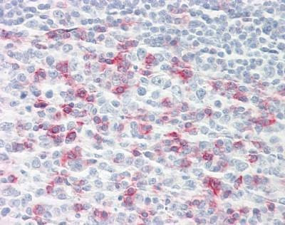 Anti-CD279 / PD-1 Antibody
