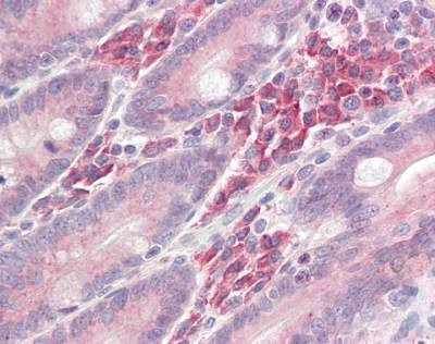 Anti-LAT1 / LAT (aa70-120) Antibody