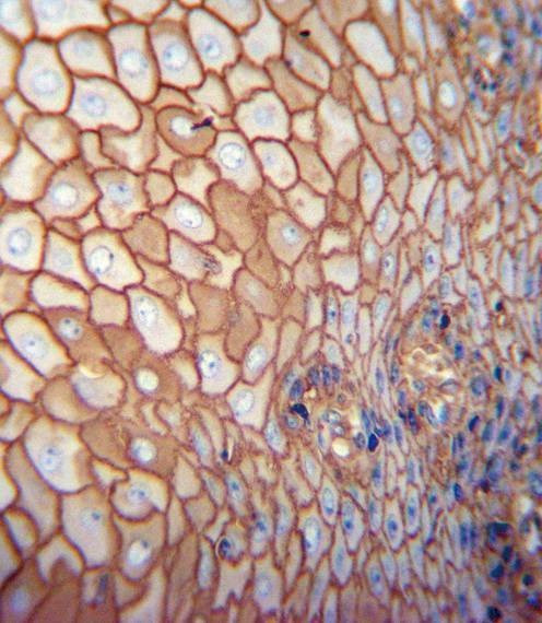 Anti-CD44 Antibody