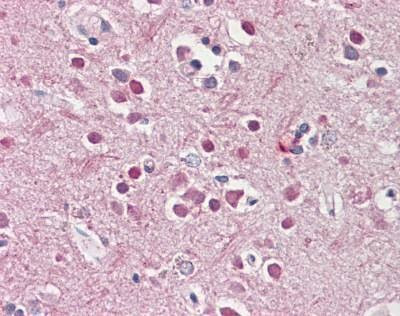Anti-CHRNB2 (Internal) Antibody