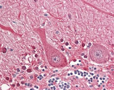 Anti-SEPT4 / Septin-4 (Internal) Antibody