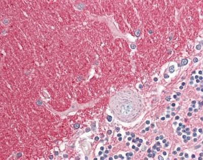Anti-GNB3 (Internal) Antibody