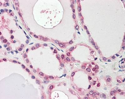 Anti-NEK7 (Internal) Antibody