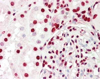 Anti-Ku70/Ku80 (XRCC6/XRCC5) (C-term) Antibody