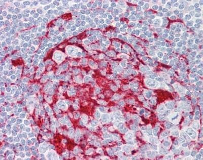 Anti-LRAT (Internal) Antibody