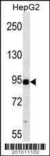 Anti-MAP3K11 (ascites) Antibody