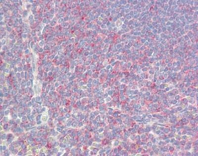 Anti-NREP (Internal) Antibody