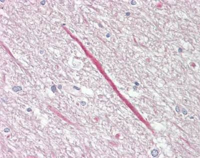 Anti-KCNT1 (C-term) Antibody