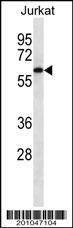 Anti-CAMKK2 Antibody