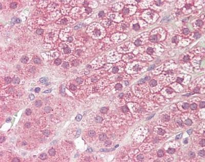 Anti-DIAP3 / DIAPH3 Antibody