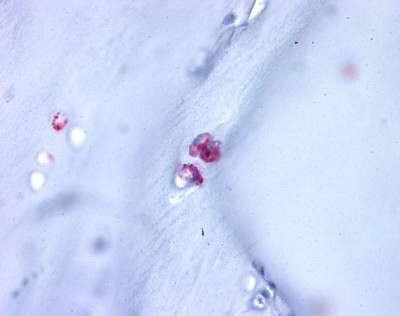 Anti-Aggrecan (C-term) Antibody