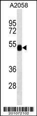 Anti-FUCA2 Antibody