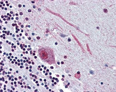 Anti-SGLT4 / SLC5A9 (Internal) Antibody