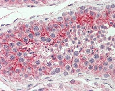Anti-CXADR (Internal) Antibody
