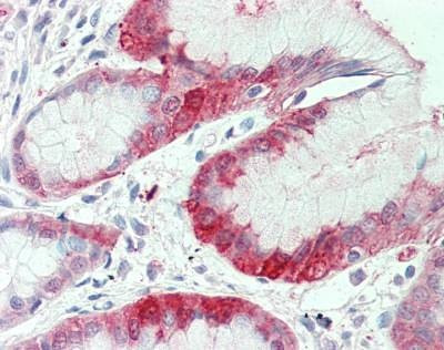 Anti-SLC7A2 (C-term) Antibody