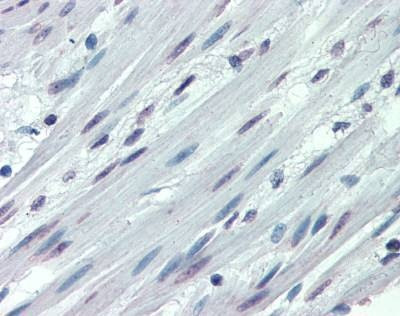 Anti-ITGA3 / CD49c (N-term) Antibody