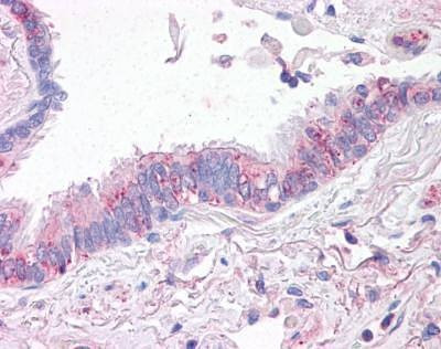 Anti-SLC31A1 / CTR1 (Internal) Antibody