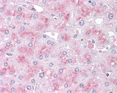 Anti-SLITRK6 (Internal) Antibody