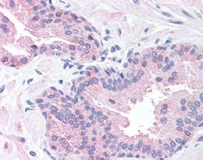 Anti-SLITRK6 (Internal) Antibody