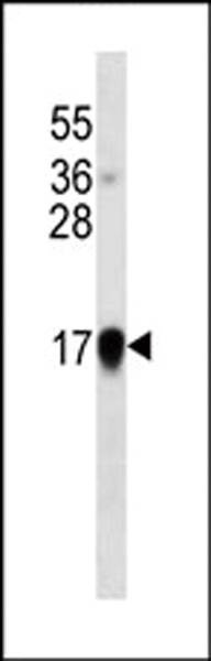 Anti-Interferon-alpha Antibody