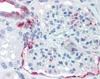 Anti-ZIP14 / SLC39A14 (Internal) Antibody