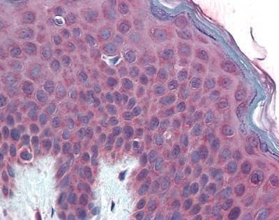 Anti-TM9SF3 (Internal) Antibody