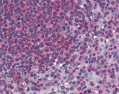 Anti-TM9SF3 (Internal) Antibody