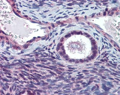 Anti-HELO1 / ELOVL5 (N-term) Antibody