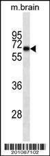 Anti-INA Antibody