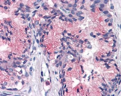 Anti-ATP1B3 (Internal) Antibody