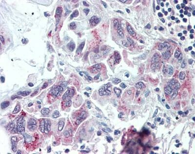 Anti-TMPRSS4 (Internal) Antibody