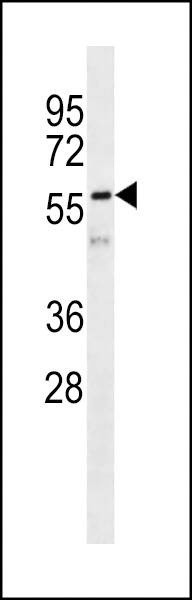 Anti-VIME Antibody
