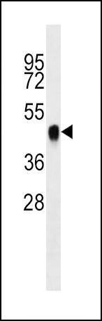 Anti-BMI1 Antibody