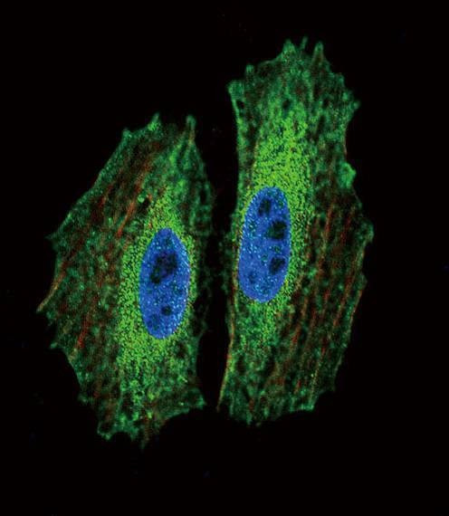 Anti-BMI1 Antibody