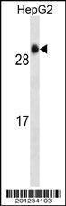 Anti-GSTA1 Antibody