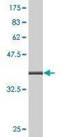 Anti-ALOX12 Antibody