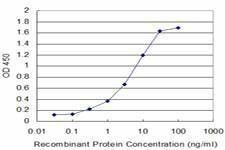 Anti-ALOX12 Antibody