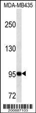 Anti-GSN (N-term) Antibody
