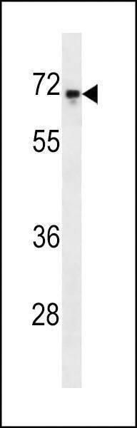 Anti-C-rel Antibody