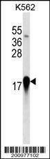 Anti-EIF4EBP1 Antibody
