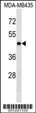 Anti-MAPK3 Antibody