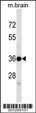 Anti-Mouse SYP (C-term) (ascites) Antibody