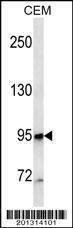 Anti-MME/CD10 (ascites) Antibody